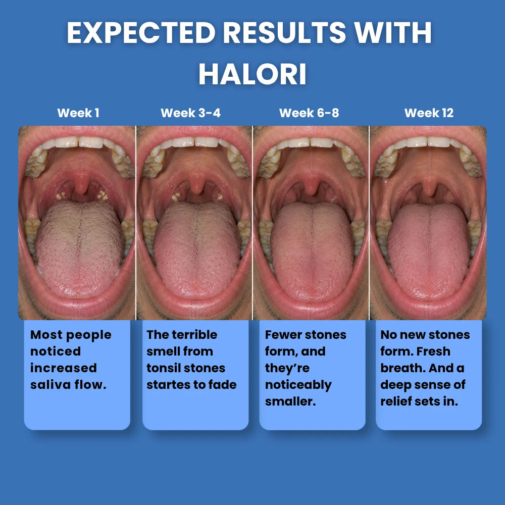Halori™ Tonsil Probiotic