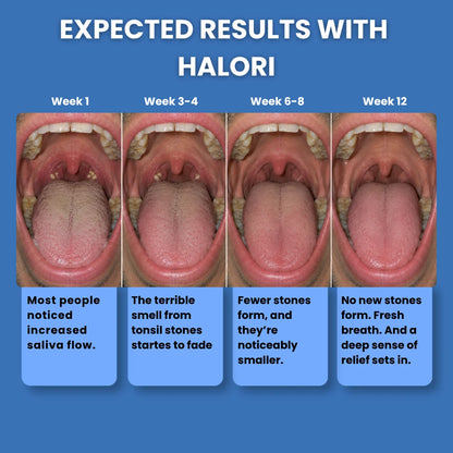 Halori™ Tonsil Probiotic