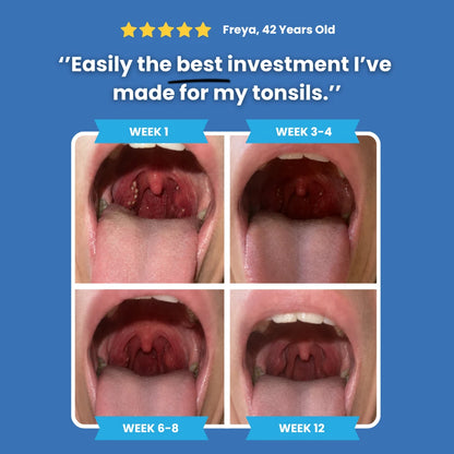 Halori™ Tonsil Probiotic