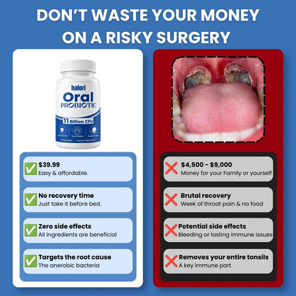 Halori™ Tonsil Probiotic