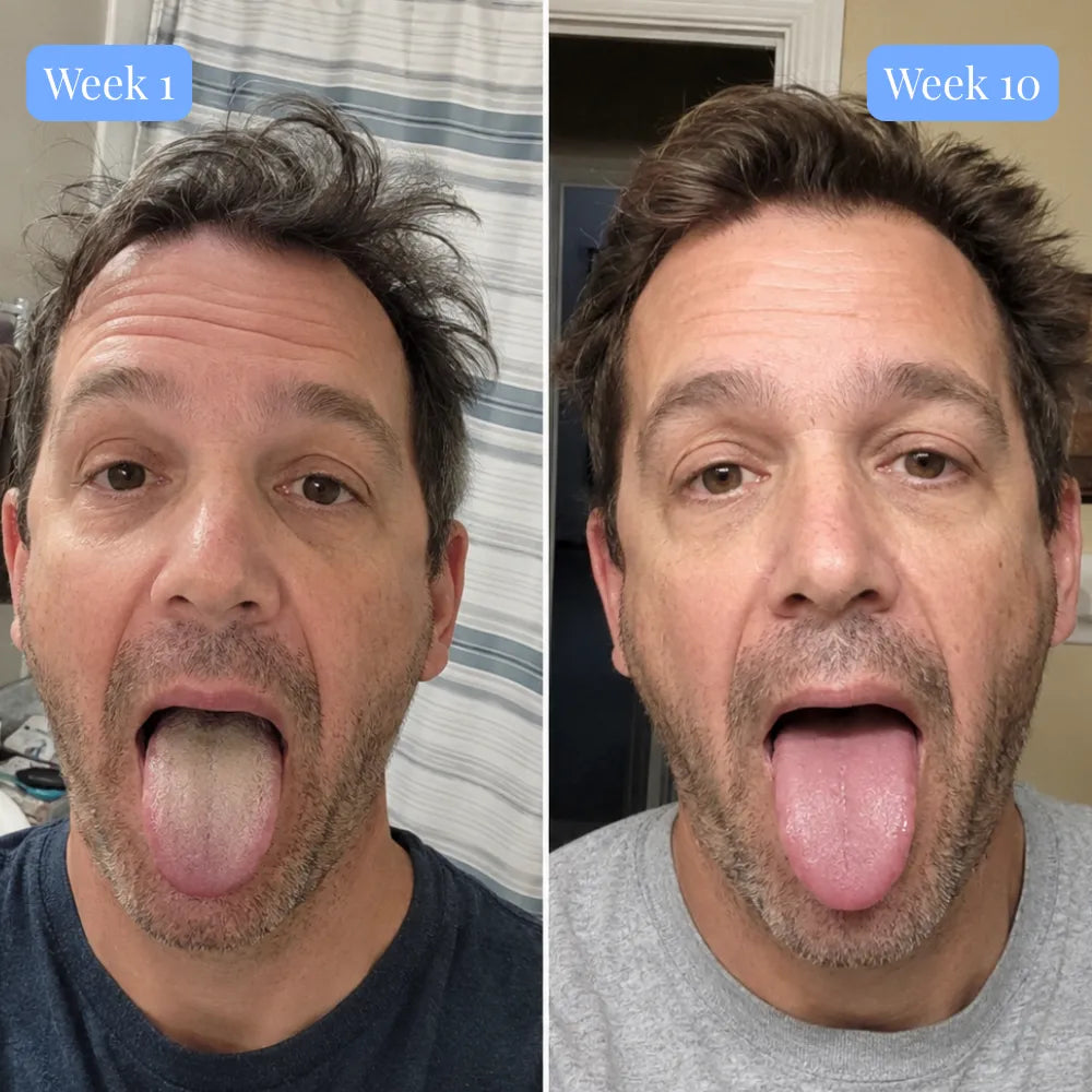 Halori™ Oral Probiotic fix tonsil stones at the source